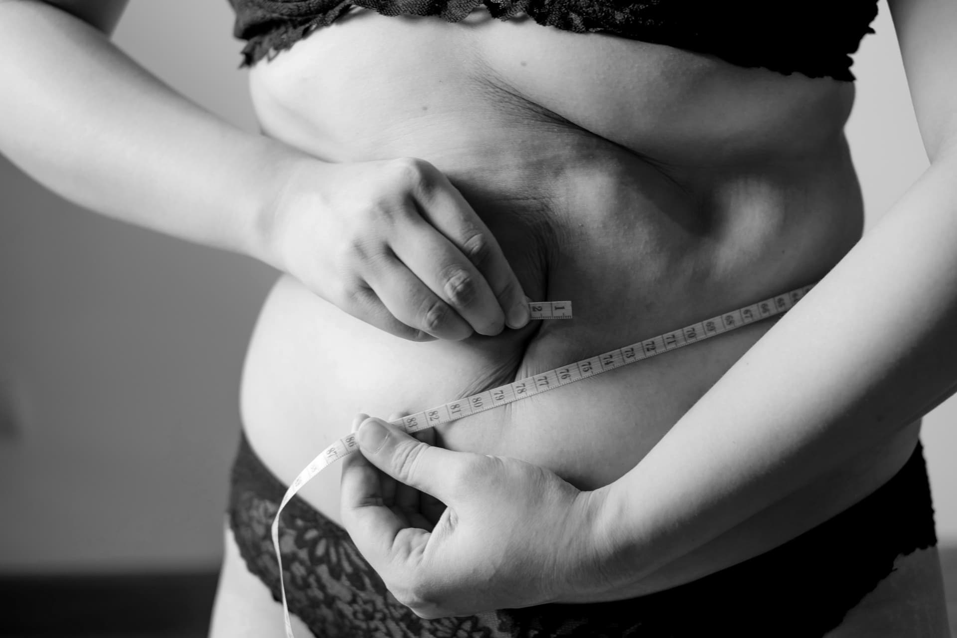 GLP-1 patches for weight management